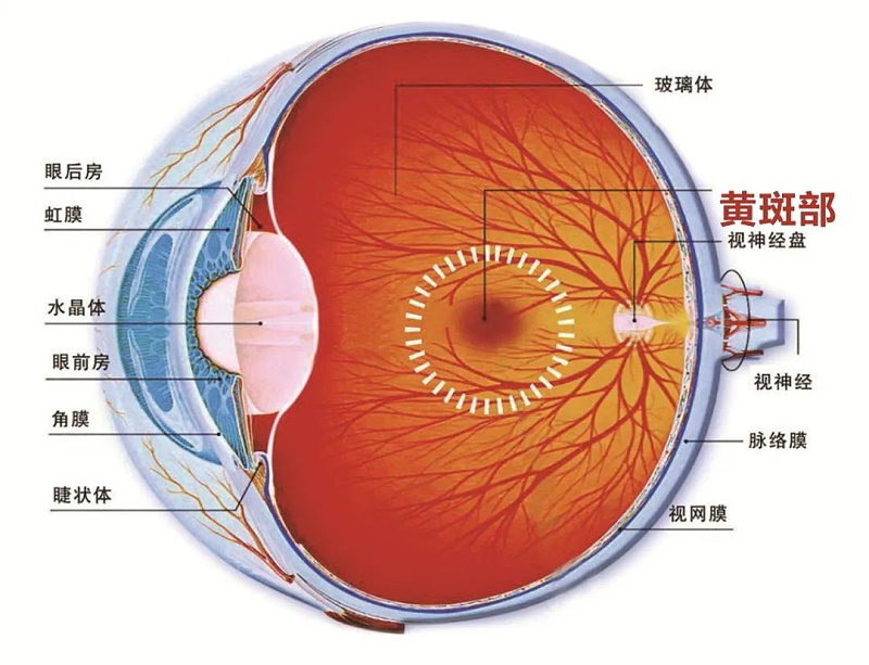 水蛭素、黃斑變性