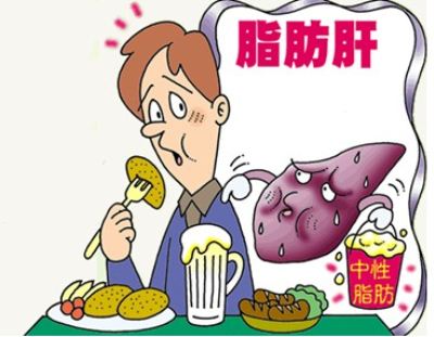 盤點(diǎn)一些關(guān)于脂肪肝的誤區(qū)