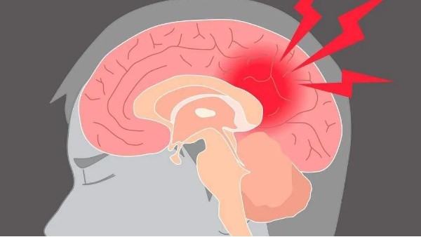 水蛭治療缺血性腦血管病療效肯定、安全簡(jiǎn)便，已被各家公認(rèn)