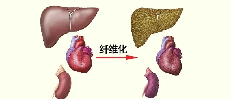 水蛭素、活血化瘀、纖維化