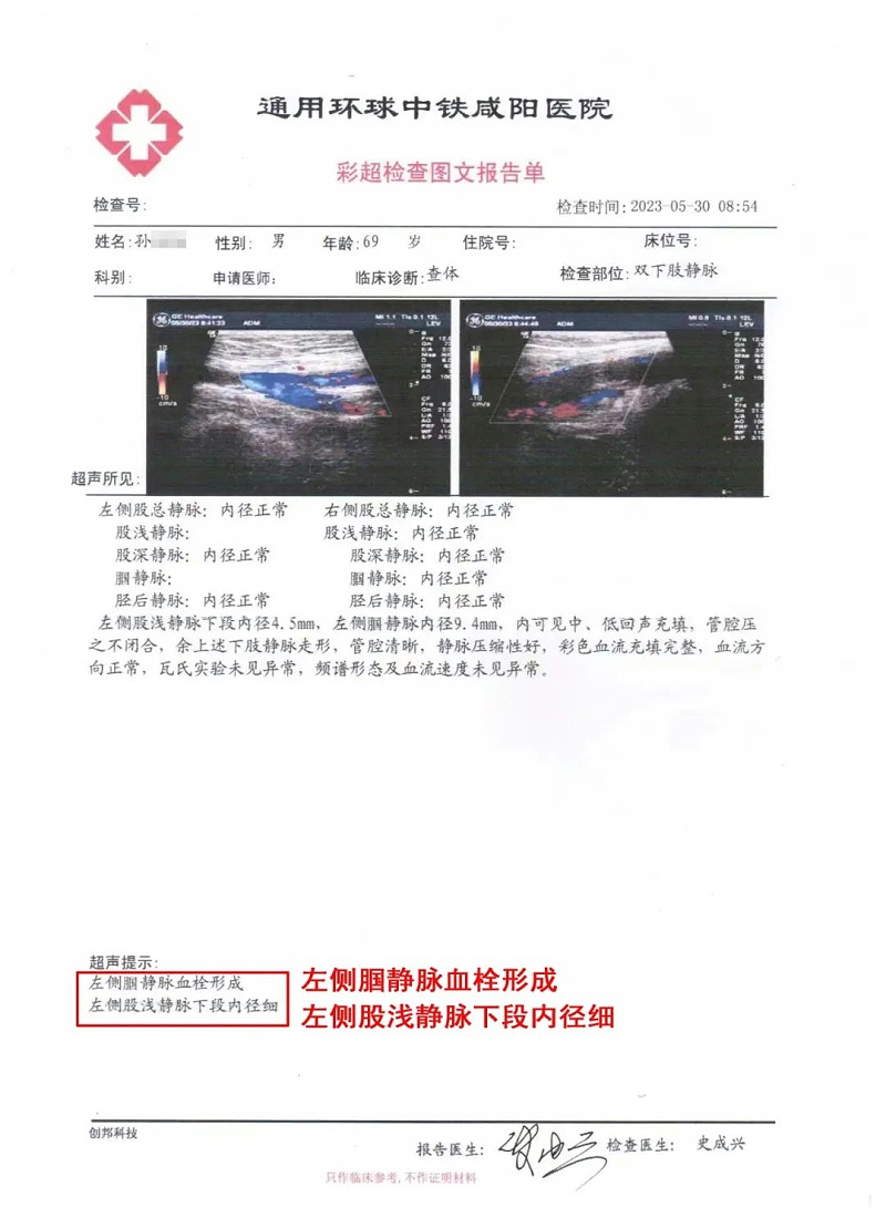 水蛭素、水蛭素膠囊、壯醫(yī)水蛭療法