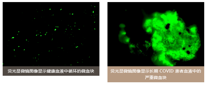 水蛭素、老年癡呆、前列腺、陽(yáng)康