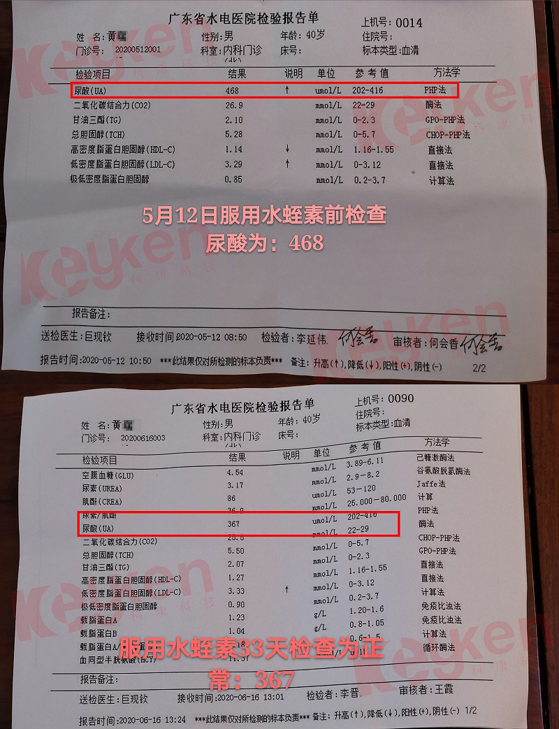 水蛭素、尿酸、痛風