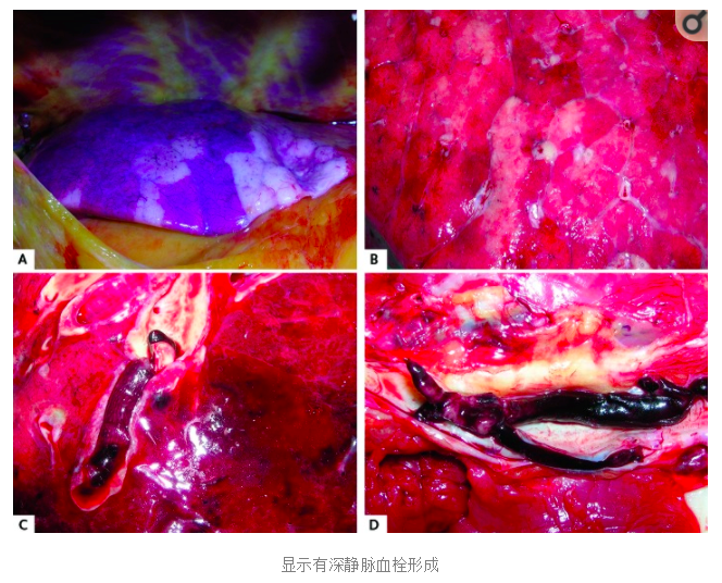 水蛭素、陽康、烏梅、壯醫(yī)水蛭療法