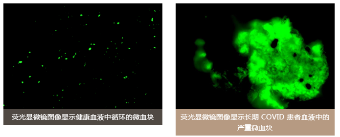 水蛭素、陽康、烏梅、壯醫(yī)水蛭療法