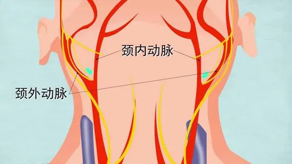 水蛭素、血管堵塞、粥樣硬化